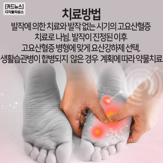 [카드뉴스]바람만 스쳐도 아파요 통풍 증상과 치료방법 - 디지털타임스